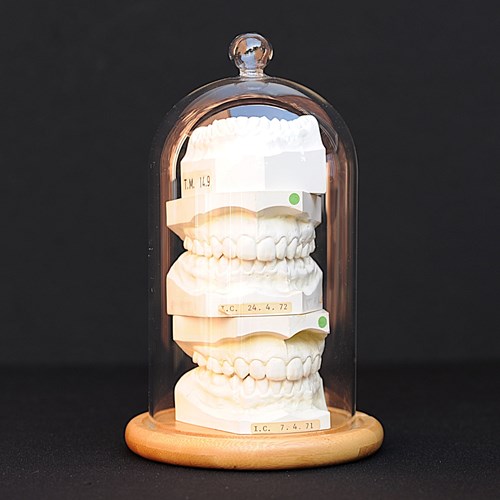 Teeth In Dome Oddity Jaw Dentist Tooth Medical Skeleton Science Doctor Pathology