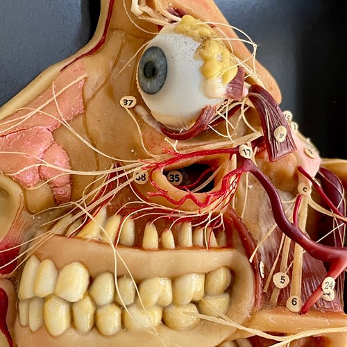 German Cased Anatomical Model
