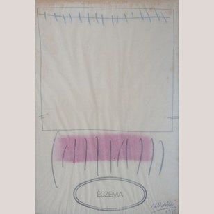 Éczema – Signed Mixed Media Abstrac...