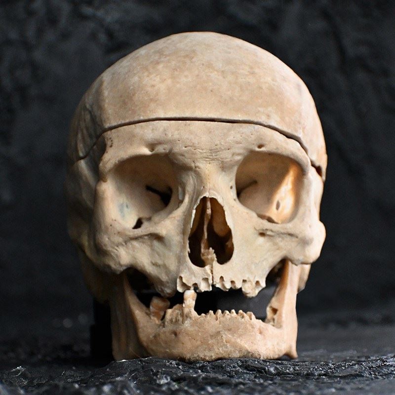 Medical Skull Example-the-house-of-antiques-dsc-9867-main-638211170971999981.jpg