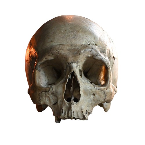 Human Skull Specimen