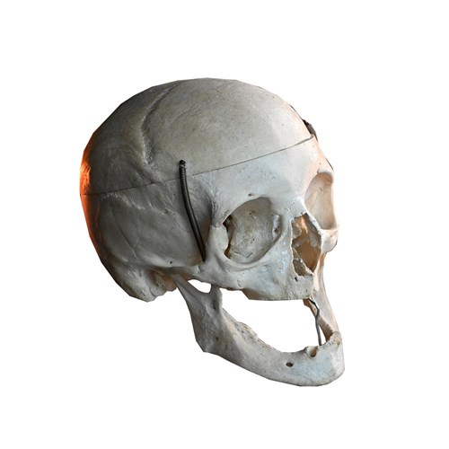 Human Skull Specimen
